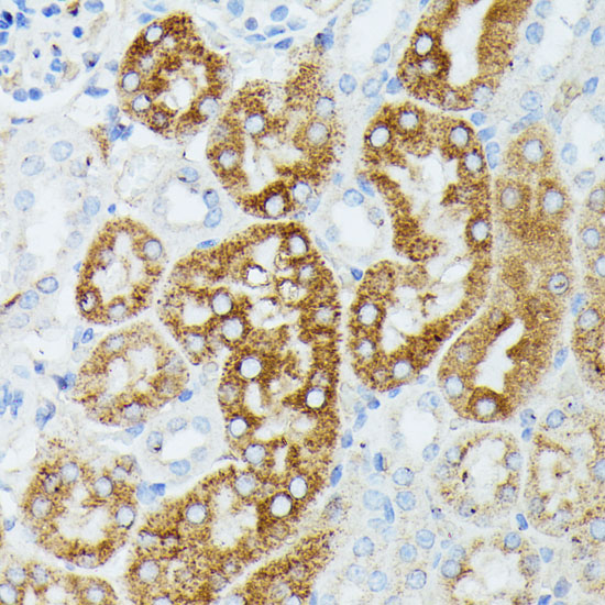 Anti-MAP3K1 Antibody (CAB16057)