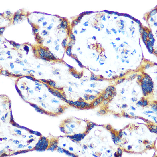 Anti-GDF15 Antibody (CAB0185)