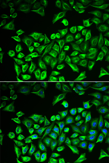 Anti-HAS3 Antibody (CAB13498)