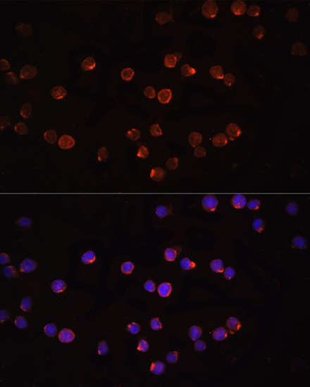 Anti-IL-1 beta Antibody (CAB16288)