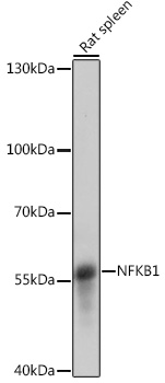 Anti-NFKB1 Antibody (CAB14754)