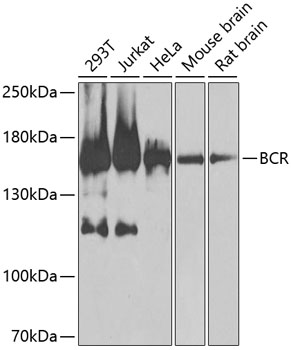 Anti-BCR Antibody (CAB0068)