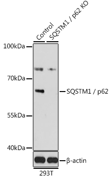 Anti-SQSTM1 / p62 Antibody [KO Validated] (CAB19700)