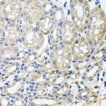 Anti-ST8SIA2 Antibody (CAB7748)