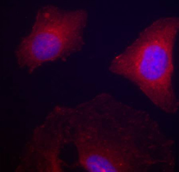 Anti-Phospho-GSK3B-Y216 Antibody (CABP0261)