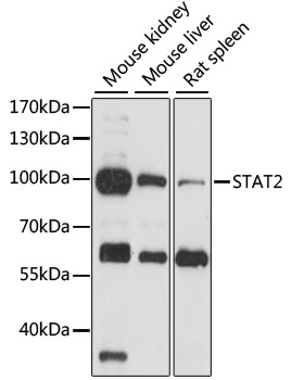 Anti-STAT2 Antibody (CAB14995)