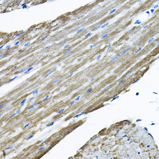 Anti-UBE2F Antibody (CAB5160)