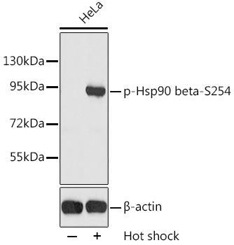 Anti-Phospho-HSP90AB1-S254 Antibody (CABP0203)