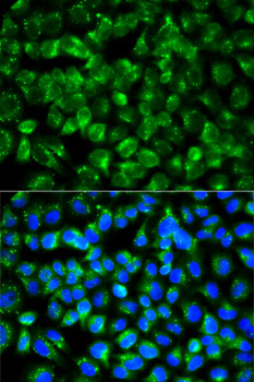 Anti-IL-1R2 Antibody (CAB14072)