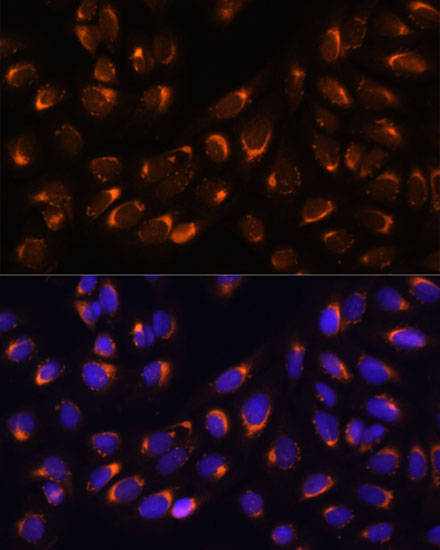 Anti-NUCB1 Antibody [KO Validated] (CAB3994)