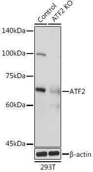 Anti-ATF2 Antibody [KO Validated] (CAB2155)