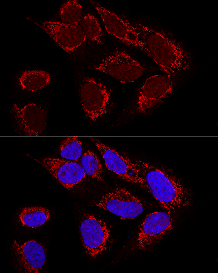 Anti-Metaxin-2 Polyclonal Antibody (CAB7958)