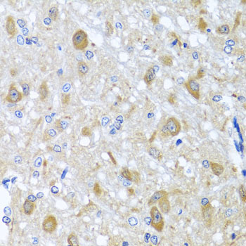 Anti-BNIP3L Antibody (CAB6283)