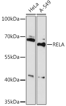 Anti-RELA Antibody (CAB16728)