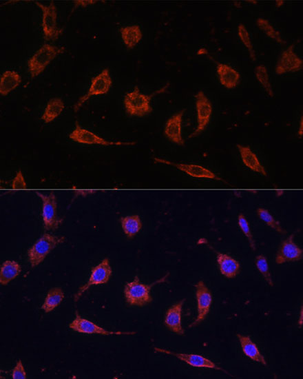 Anti-TOLLIP Antibody (CAB2202)