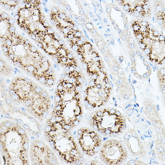 Anti-NEU1 Antibody (CAB6299)