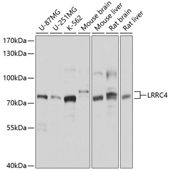 Anti-LRRC4 Antibody (CAB10321)