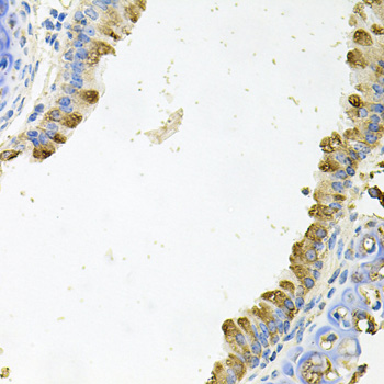 Anti-KLK11 Antibody (CAB6641)