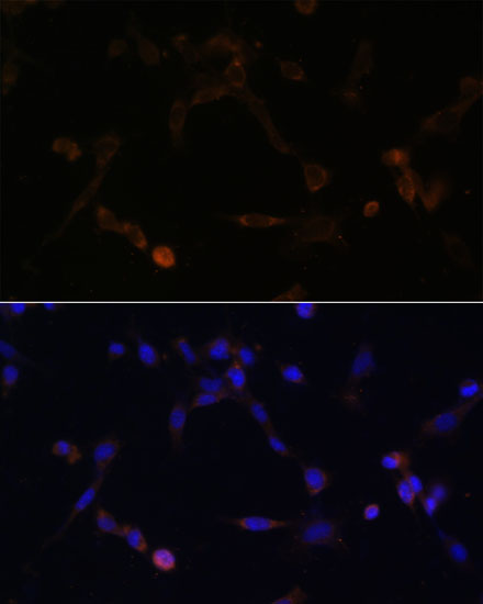 Anti-UBE2L6 Antibody (CAB13670)