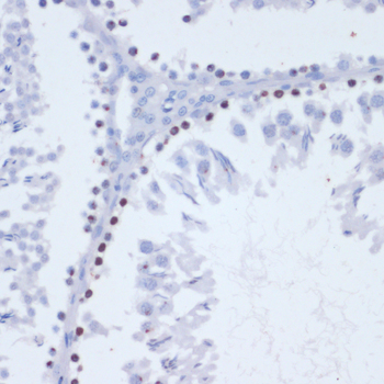 Anti-Phospho-Histone H2AFX-S139 Antibody (CABP0099)