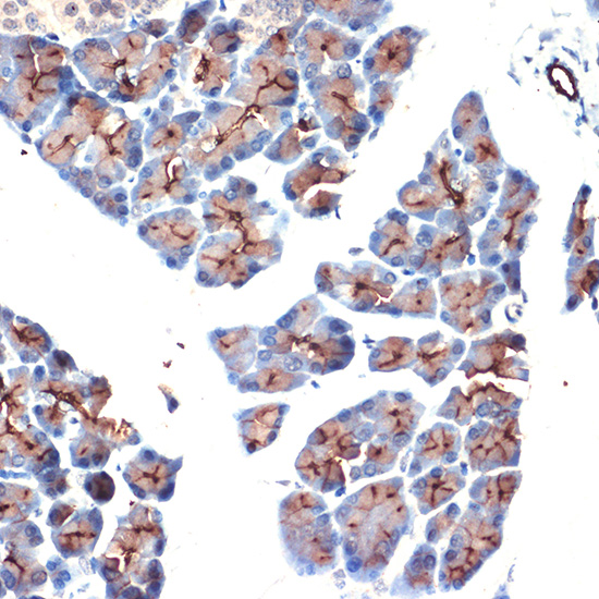 Anti-MUC1 Antibody (CAB0333)