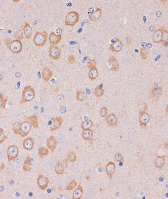 Anti-TRAPPC6B Antibody (CAB15561)