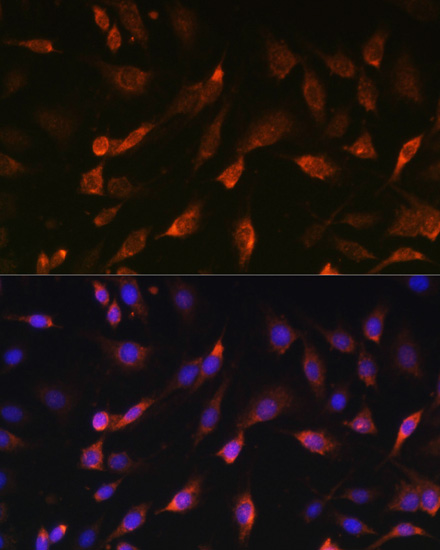 Anti-STIM1 Antibody (CAB7411)