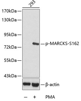 Anti-Phospho-MARCKS-S162 Antibody (CABP0403)