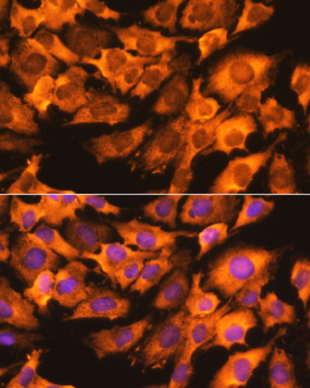 Anti-RPS3 Antibody (CAB13543)