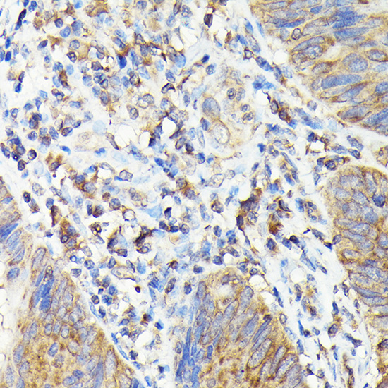 Anti-TAP2 Antibody (CAB1610)