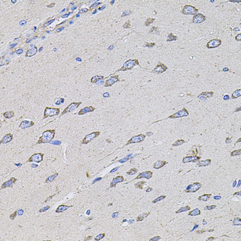 Anti-TMC1 Polyclonal Antibody (CAB8595)