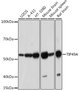 Anti-TIP49A Antibody (CAB5180)