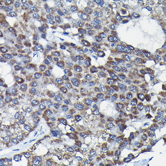 Anti-RGS14 Polyclonal Antibody (CAB9962)