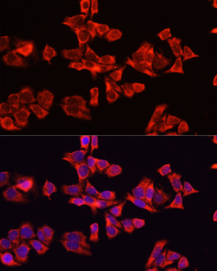 Anti-Albumin Antibody (CAB1363)