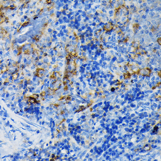 Anti-TNFR1 Antibody (CAB1540)