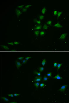 Anti-PPOX Antibody (CAB6397)