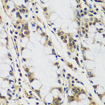 Anti-CASC5 Antibody (CAB13108)