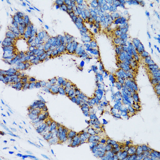 Anti-SIAH1 Antibody (CAB2494)