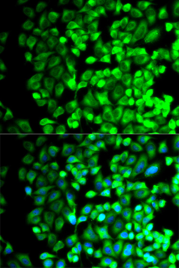 Anti-TBXAS1 Antibody (CAB13362)