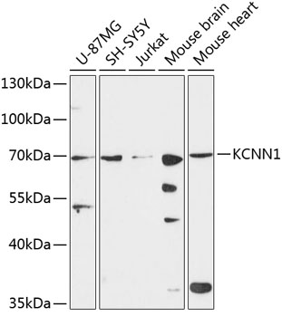 Anti-KCNN1 Polyclonal Antibody (CAB9322)