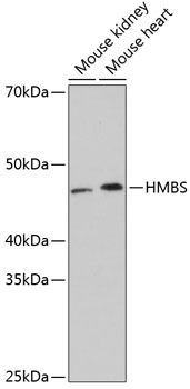 Anti-HMBS Antibody