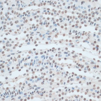 Anti-ZNF433 Antibody (CAB14972)