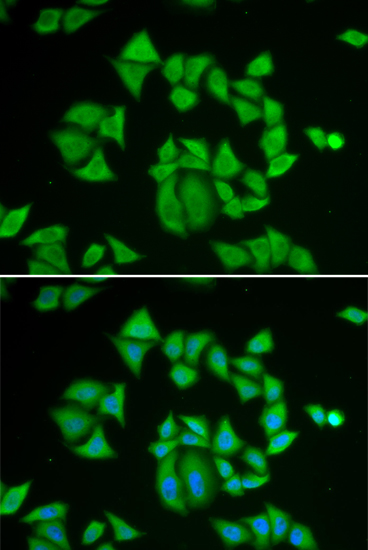 Anti-GSTM2 Antibody (CAB13496)