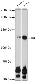 Anti-RB Antibody [KO Validated] (CAB0003)