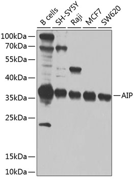 Anti-AIP Polyclonal Antibody (CAB9852)