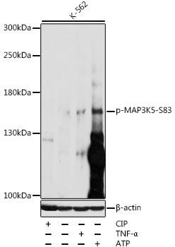 Anti-Phospho-MAP3K5-S83 Antibody (CABP0059)