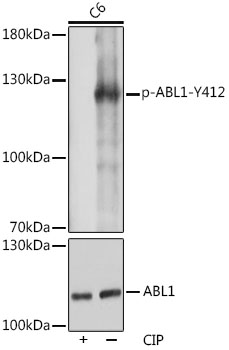 Anti-Phospho-ABL1-Y412 Antibody (CABP1060)