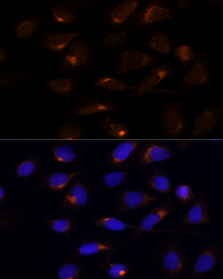 Anti-SCD Antibody [KO Validated] (CAB16429)