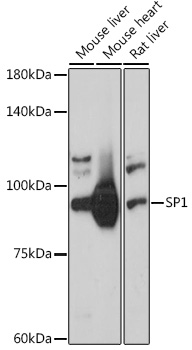 Anti-SP1 Antibody (CAB14662)