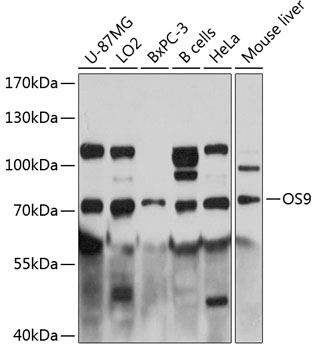 Anti-OS9 Antibody (CAB12261)